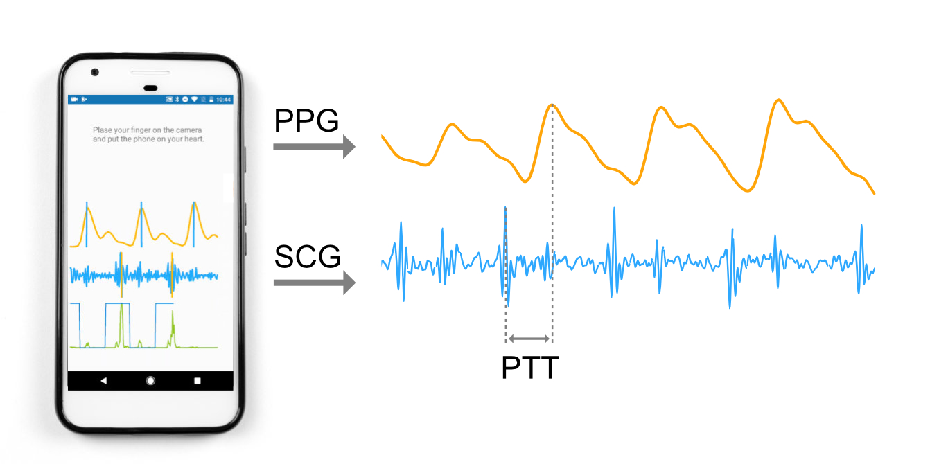 
illustration of real time pulse transit time sensing: the camera measures PPG, the accelerometer measures SCG, and the time difference between them is the PTT
